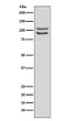FGFR4 antibody western blot Raji cells STJA0036440