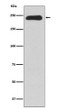 MYH11 antibody western blot human testis STJA0036441