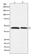 FEN1 antibody western blot HeLa Daudi lysates STJA0036455