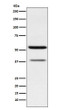 CEACAM6 antibody western blot MCF-7 cells STJA0036485