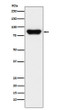 Prothrombin antibody western blot human serum lysates STJA0036486