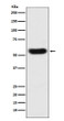 SERPINC1 antibody western blot human plasma STJA0036488