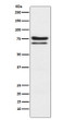 PKC epsilon antibody western blot Jurkat lysates STJA0036502