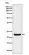 RBP4 antibody western blot HepG2 lysates STJA0036504