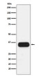 HLA DQA1 antibody western blot human spleen STJA0036514