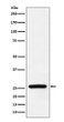 Superoxide Dismutase 3 antibody western blot human fetal heart STJA0036531