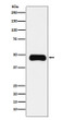 ETS1 antibody western blot Insulin Receptor R Daudi STJA0036563