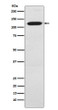 Ctip1 antibody western blot Jurkat STJA0036599