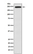 TRPM7 antibody western blot HeLa cells STJA0036602