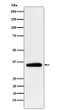 Pyruvate Dehydrogenase E1 beta antibody western blot HeLa STJA0036626