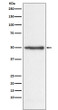 Nogo antibody western blot HeLa lysates STJA0036629