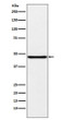 NPHS2 antibody western blot human fetal kidney STJA0036642