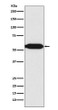 MEF2C antibody western blot Raji lysates STJA0036644