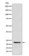 placental lactogen antibody western blot human placenta STJA0036669