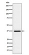 CRX antibody western blot Y79 cell lysate STJA0036684