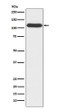 OGT antibody western blot A549 lysates STJA0036699