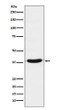 VPS26 antibody western blot A431 cells STJA0036707
