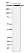 Plexin A1 antibody western blot HUVEC STJA0036731