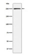 MYH11 antibody western blot human bladder lysates STJA0036741