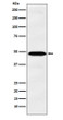 IL-13 Receptor alpha 1 antibody western blot A549 cells STJA0036743