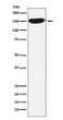 CPS1 antibody western blot HeLa lysates STJA0036762
