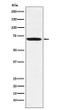 LIM Kinase 1 antibody western blot U87-MG lysates STJA0036770