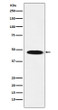 GABA A Receptor beta 1 antibody western blot human cerebellum STJA0036801