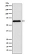 PARP2 antibody western blot Raji STJA0036833