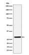 FHL2 antibody western blot SW480 lysates STJA0036881