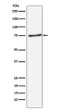 PIAS1 antibody western blot Daudi lysates STJA0036894