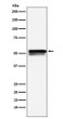 EGR2 antibody western blot LnCaP lysates STJA0036921