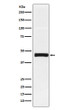 Pentraxin 3 antibody western blot HUVEC STJA0036973