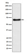 CYP24A1 antibody western blot human fetal liver STJA0037019