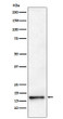 AP2S1 antibody western blot HeLa cells STJA0037050