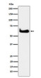 TCP1 alpha antibody western blot HeLa lysates STJA0037068
