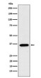 FBP1 antibody western blot MCF-7 lysates STJA0037071
