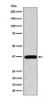 FBP1 antibody western blot MCF-7 lysates STJA0037117