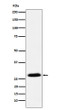 GSC antibody western blot MCF-7 lysates STJA0037120