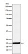 Y14 antibody western blot HepG2 lysates STJA0037153
