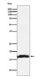 CRYAA antibody western blot mouse eyeball STJA0037185