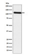 Fibrinogen alpha chain antibody western blot human plasma STJA0037209