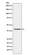 PAR4 antibody western blot LnCaP lysates STJA0037245