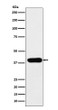 ADA antibody western blot Jurkat STJA0037246