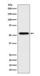 ApoH antibody western blot human plasma lysates STJA0037263