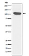 ERAP1 antibody western blot K562 lysates STJA0037320