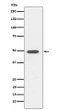 DP1 antibody western blot Raji lysates STJA0037322
