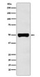 CHX10 antibody western blot Y79 lysates STJA0037343