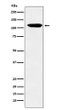 Eph receptor B3 antibody western blot MOLT4 STJA0037387