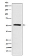 ETV6 antibody western blot A431 cells STJA0037413