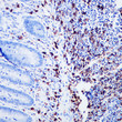 CD20 antibody immunohistochemistry paraffin-embedded appendix tissue STJA0037581